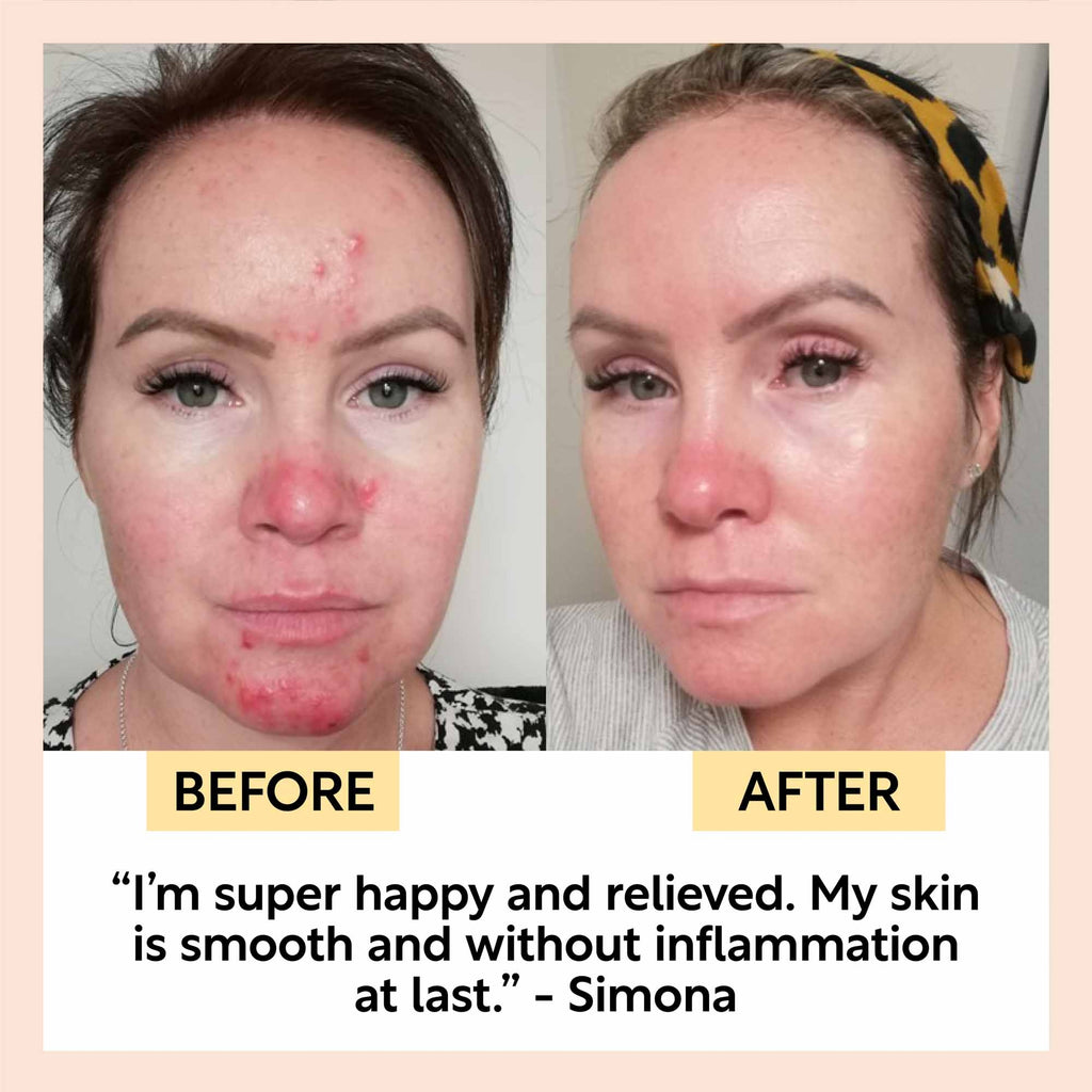 Night Cream - Hyaluronic & Niacinamide